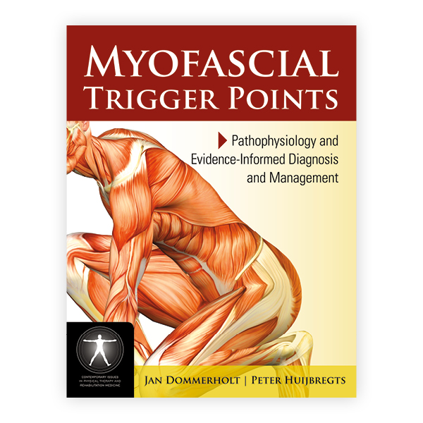 Myofascial Trigger Points: Pathophysiology And Evidence-Informed ...