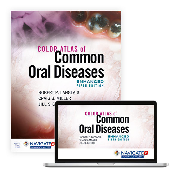 Color Atlas of Common Oral Diseases, Enhanced Edition: 9781284240986