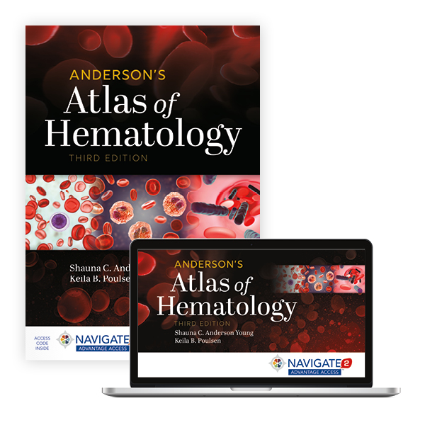 Navigate 2 Advantage Access For Anderson's Atlas Of Hematology ...